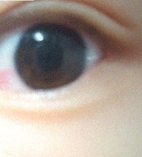 요즘 눈 상태