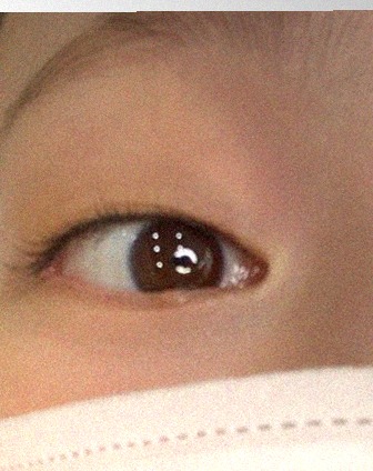 요즘 눈 상태