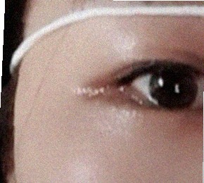 요즘 눈 상태