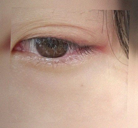 요즘 눈 상태