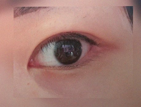 요즘 눈 상태