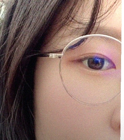 요즘 눈 상태