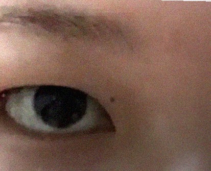 요즘 눈 상태