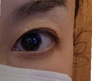 요즘 눈 상태