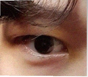 요즘 눈 상태