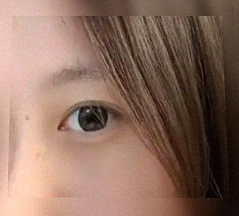 요즘 눈 상태