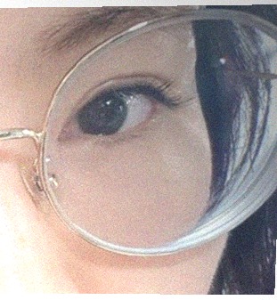 요즘 눈 상태