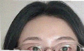 요즘 눈 상태