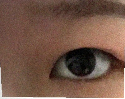 요즘 눈 상태