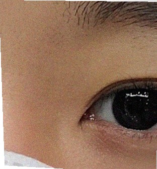 요즘 눈 상태