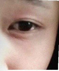 요즘 눈 상태