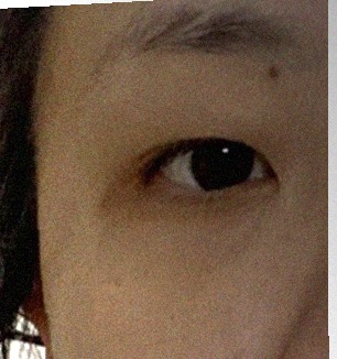요즘 눈 상태