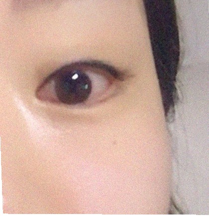 요즘 눈 상태