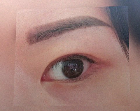 요즘 눈 상태