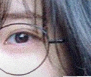 요즘 눈 상태