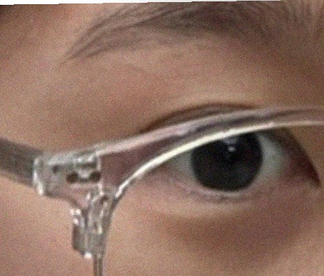 요즘 눈 상태