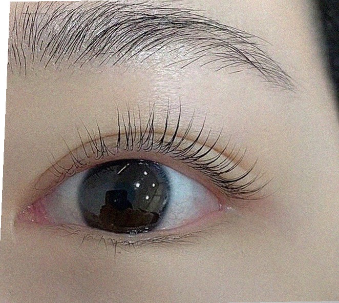 요즘 눈 상태