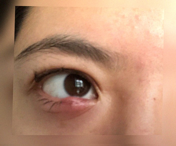 요즘 눈 상태