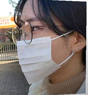 요즘 눈 상태