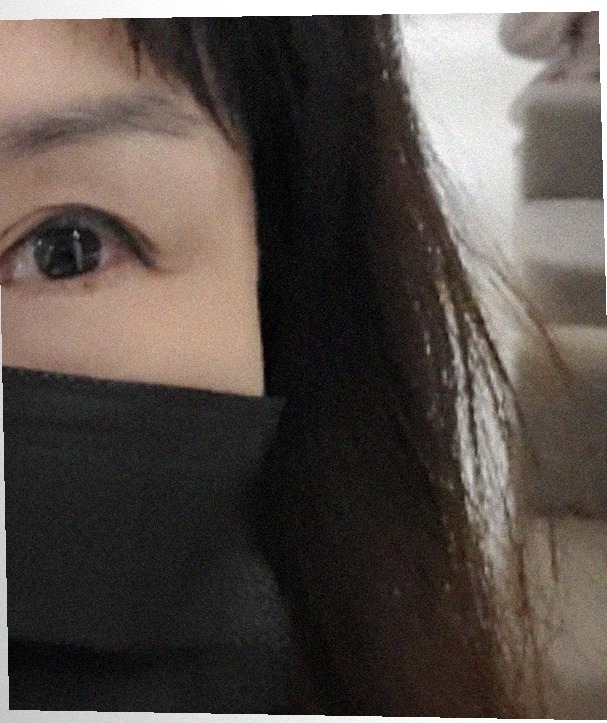 요즘 눈 상태