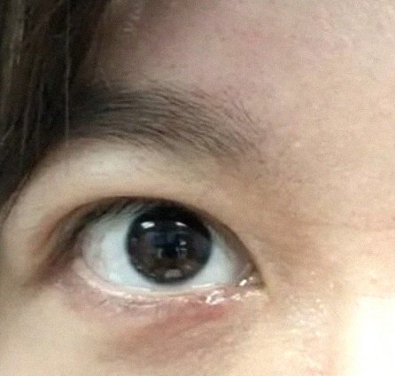 요즘 눈 상태