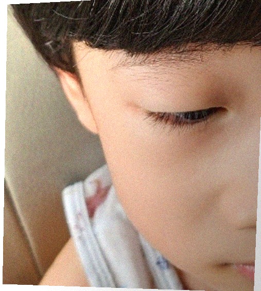 요즘 눈 상태