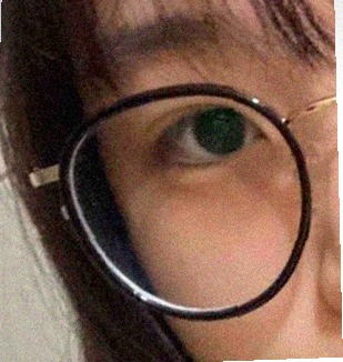 요즘 눈 상태