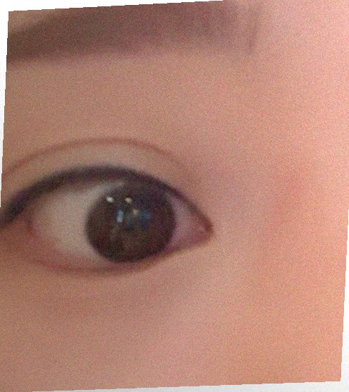요즘 눈 상태