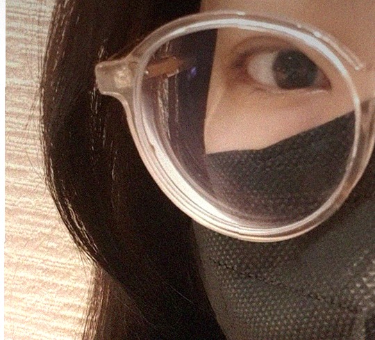 요즘 눈 상태