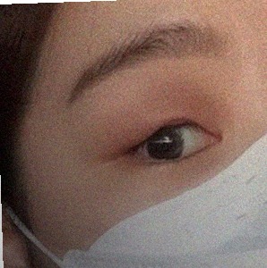 요즘 눈 상태