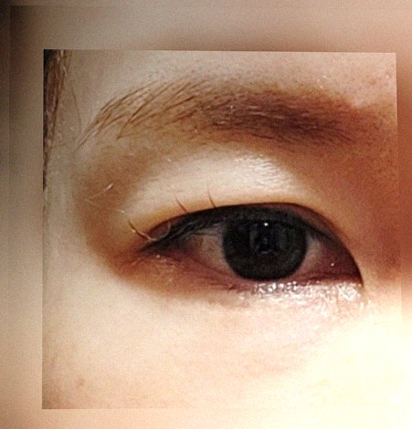 요즘 눈 상태