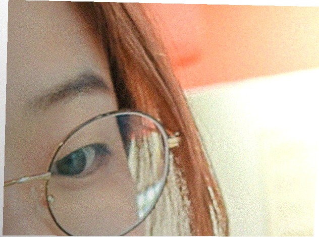 요즘 눈 상태