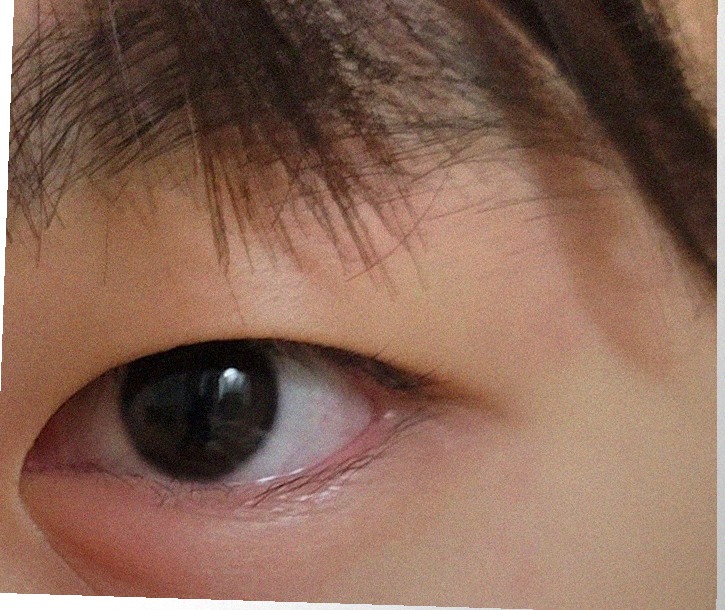 요즘 눈 상태