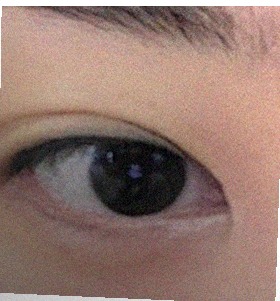 요즘 눈 상태