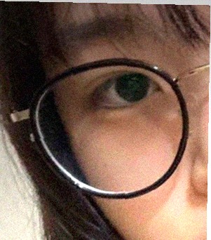 요즘 눈 상태