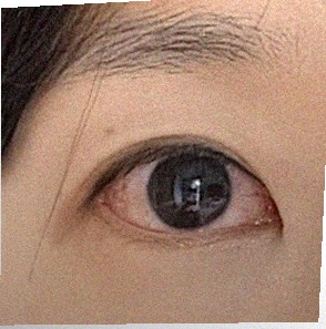 요즘 눈 상태